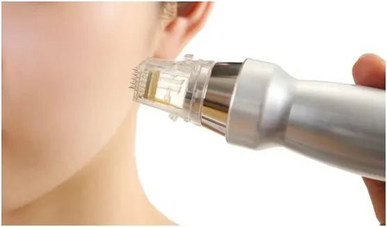 Before and after image of a woman receiving Botox treatments